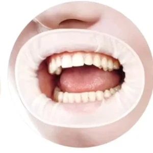 O Shape Dental Rubber Dam Mouth Opener Intraoral Blue White Cheek Retractors Multi Purpose Oral Hygiene Surgery Tool